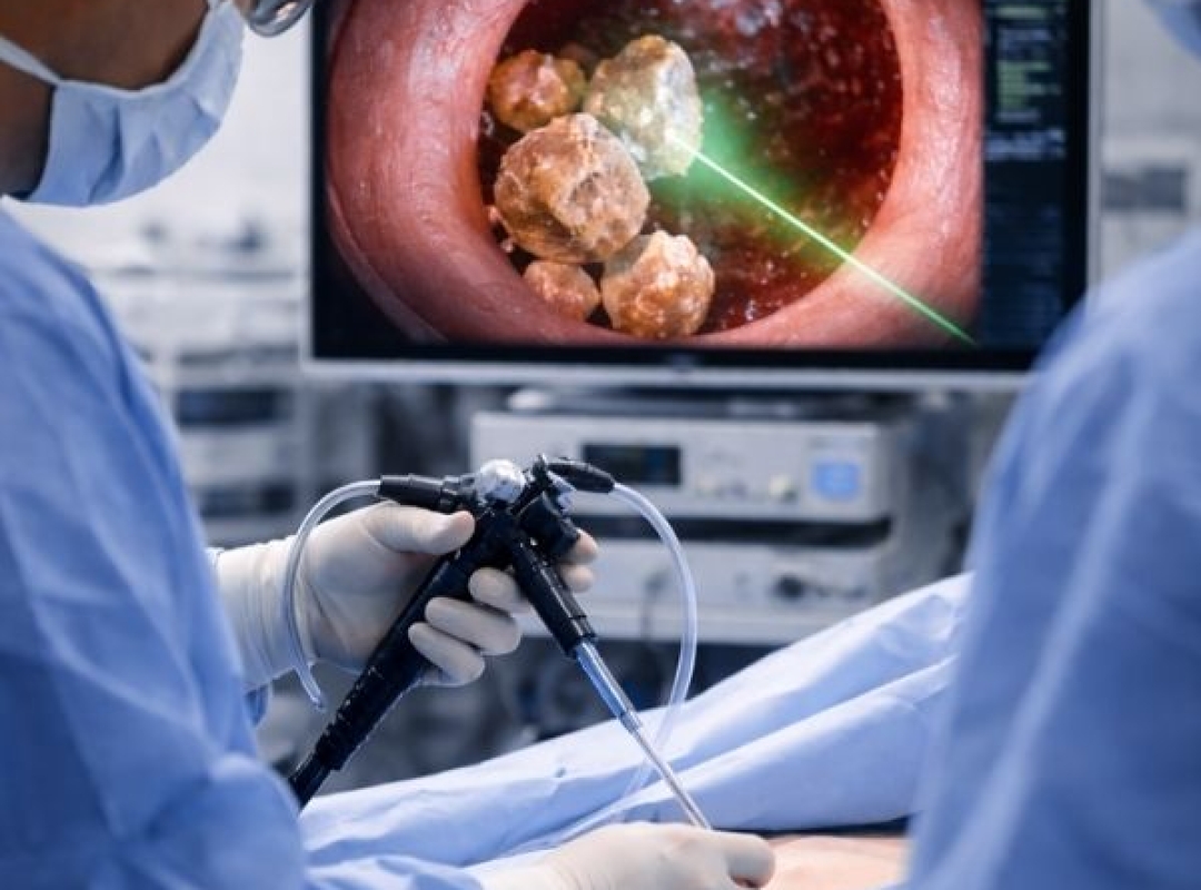 Endoscopic Treatment of Stone Diseases
