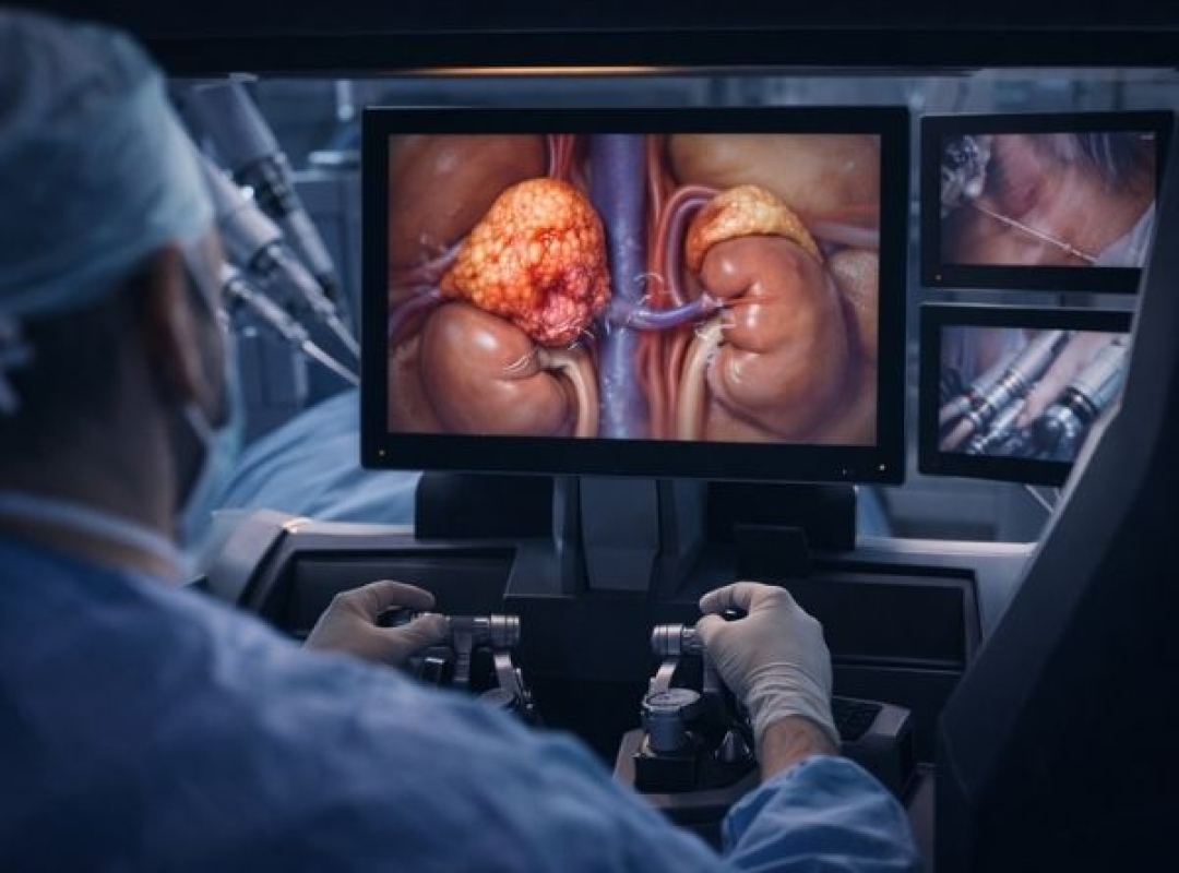 Robotic Surgery for Adrenal Tumors & Diseases