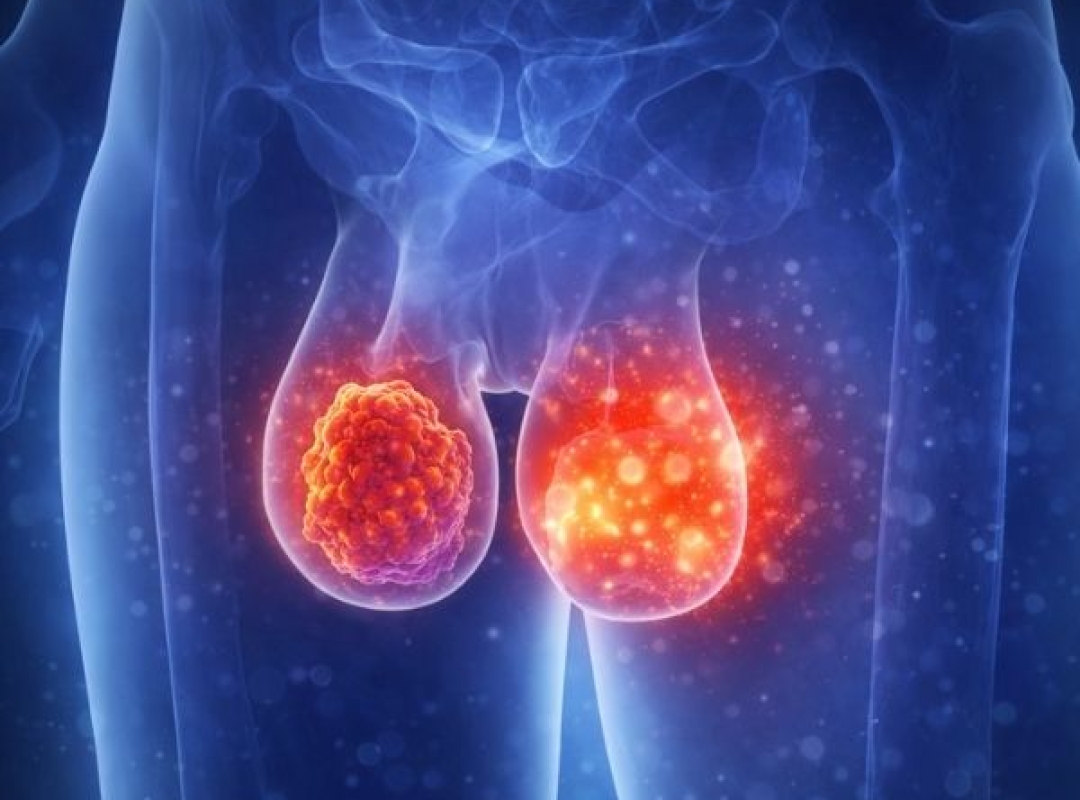 Testicular and Scrotal Diseases