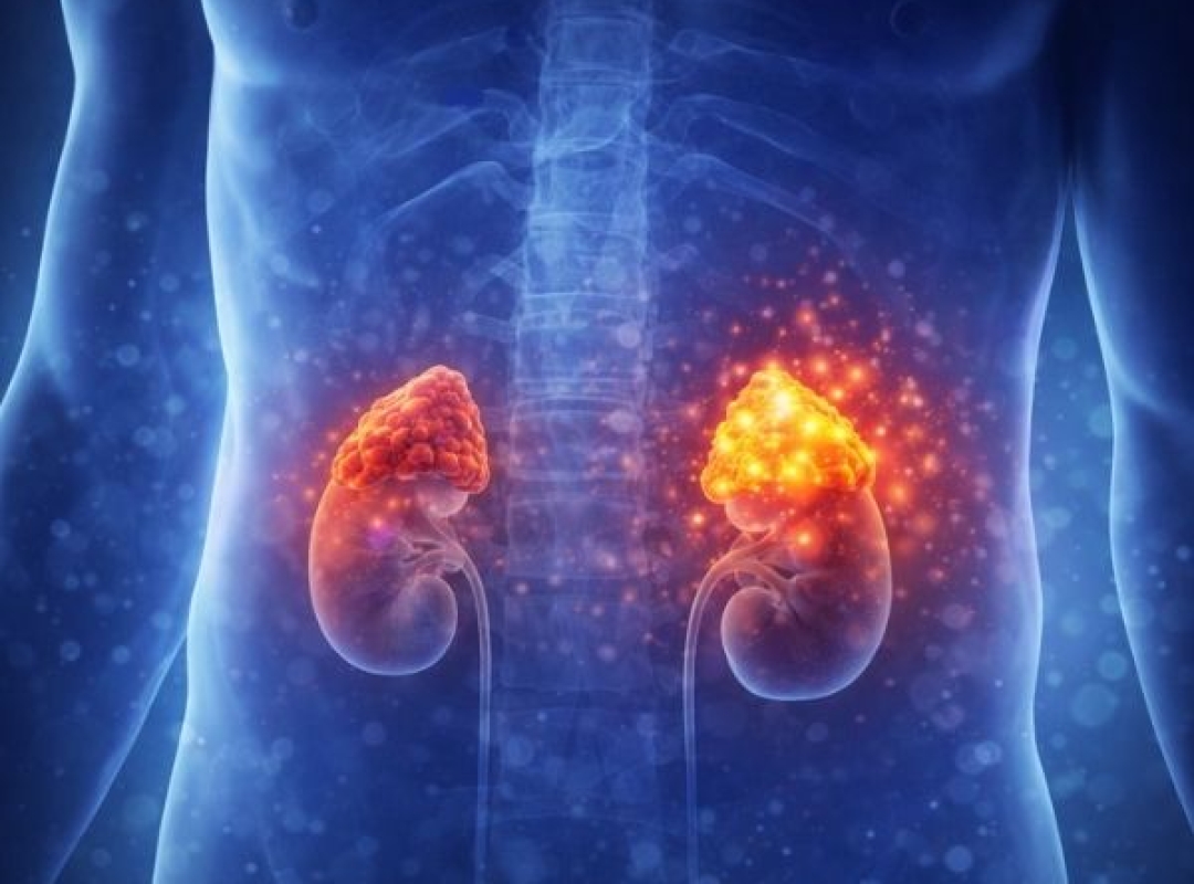 Adrenal Gland (Adrenal) Diseases