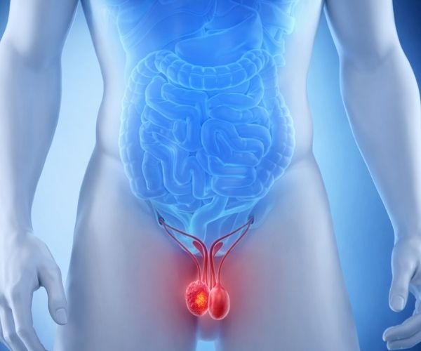 Testis Kanserinde Robotik Cerrahi