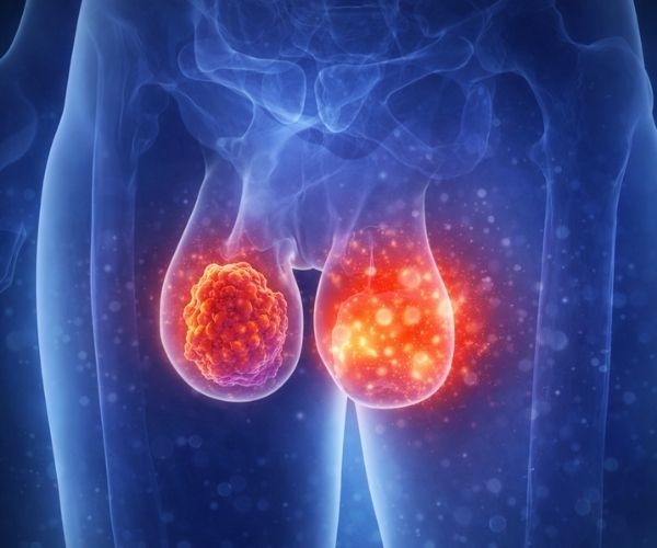 Testis ve Scrotum Hastalıkları