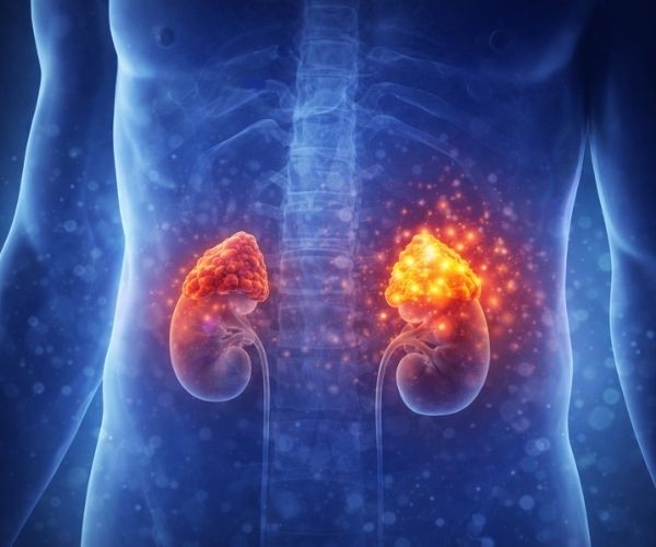 Böbrek Üstü Bezi (Adrenal) Hastalıkları